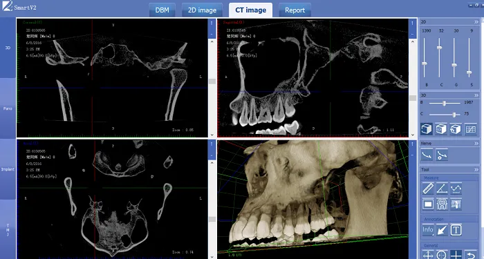Где используется частотный панорамный цифровой стоматологический рентгеновский аппарат?