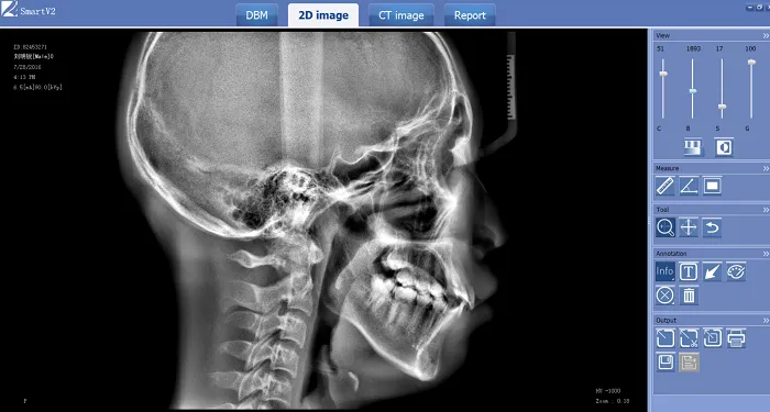 Использоваться для съемки стоматологического панорамного и цефлометрического изображения, может получить цифровое изображение напрямую.