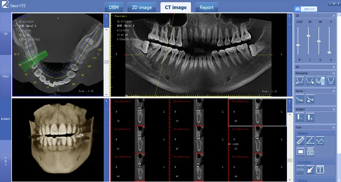 панорамный рентгеновский аппарат для стоматологии