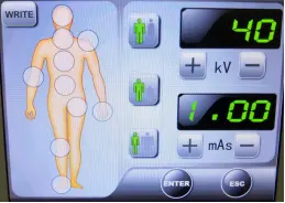 Революция в диагностике: Мобильный рентгеновский аппарат